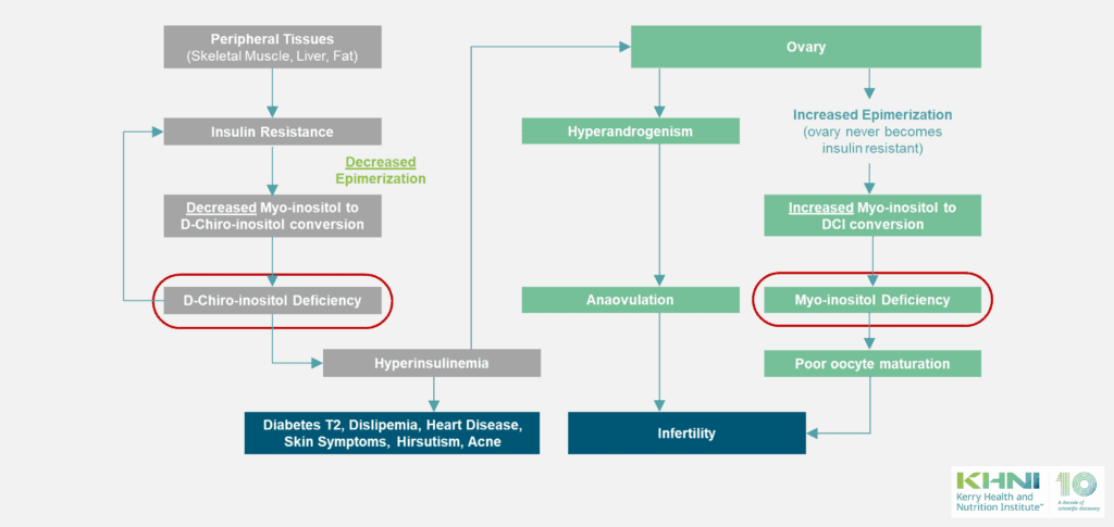 PCOS impacting Fertility